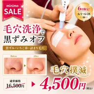 6/1〜6/28限定⭐️毛穴撲滅【黒ずみ/ざらつき/いちご鼻】毛穴すっきり洗浄＋保湿ケア⭐️90分