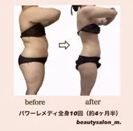 仮予約【2ヶ月集中痩身】パワーレメディ全身60分＋発汗付🔥　根本から見直す、徹底ケア🔥✨