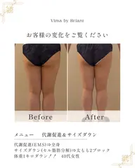【代謝促進EMS+実用新案技術サイズダウン3パーツ】モニター/当サロンはセル脂肪✨️燃焼実用新案機器を使用しております