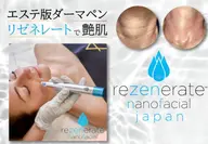 【毛穴・クレーター・引き締め・透明感◎】クリニック人気施術エステ版ダーマエステ60分