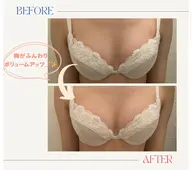 【8月限定】10〜20代に大人気☁️育乳マッサージ