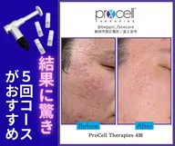 【5月中予約限定残り1名様】たるみ毛穴凹凸肌を土台～バイオ成長因子速攻肌ケアトリートメント  5回コース