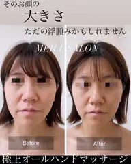 【モニター様特別価格🙌】造形小顔リンパ極上マッサージ💆🏼‍♀️✨💕 （肩首、デコルテ、肩甲骨、お顔）＋鎮静パック