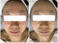 【美肌エステ】デコルテケア付でリラックス!ワンランク上の極上フェイシャルエステ💆♀️肌質&トラブル別パック付き🩷