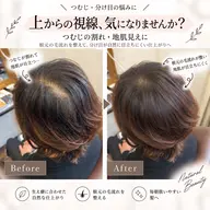 【モデル募集🌿】つむじ・前髪の割れに｜生え癖矯正1箇所