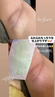 🏖️夏の人気脱毛2点セット🔥VIO+脇ワックス脱毛!!