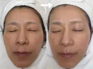 トロイピール