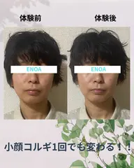 【1周年キャンペーン】人気NO.1輪郭矯正小顔コルギ+ドライヘッドスパ¥5500