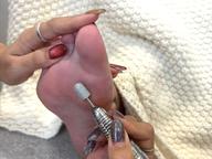 ドイツ式角質ケア🦶🏻