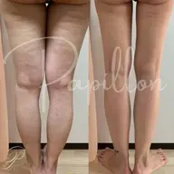 下腹▪️太もも✨半身集中ダイエット ¥6,600