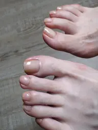 フットネイルケア