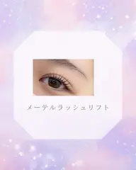 メーテルラッシュリフト