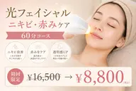 【光フェイシャル】ニキビ・赤みケアコース