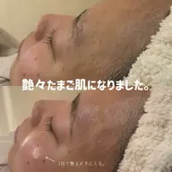【ダイヤモンドエステ】face waxトリートメント 全顔60min