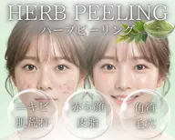 【ニキビ/毛穴/シミ】剥けないハーブピーリング🌿鎮静保湿パック付き💕