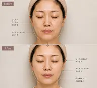 【アロマ使用】フェイスリフトケア＆ドライヘッド（小顔ツボケア・デコルテ・肩周り込み）50分 ※クレンジング・洗顔込み