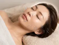 美容鍼+頭・首・肩スッキリケア鍼灸