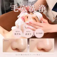 minimo限定🫧✨【毛穴の黒ずみ・詰まり・毛穴洗浄】陶肌ピール💎