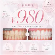 【💠minimo 掲載記念💠】韓国🇰🇷美白ホワイトニング【9 分×2 回】