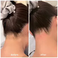 期間限定‼️うなじWax脱毛✖️THR脱毛(光脱毛)💕