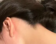 最新ハイブリッドうなじ脱毛体験✨シェービング付き