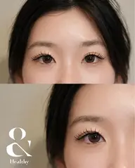 アンドヘルシー（120本まで）