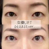 初回限定【一重・奥二重専用】まぶたリフトラッシュ　※保証つき