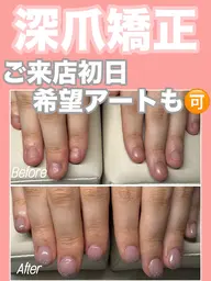 深爪矯正【長さ出し】◆カラーあり◆(オフ込)むしったり 割れたり 噛んで小さくなってしまった爪も美しく綺麗な状態に✧︎