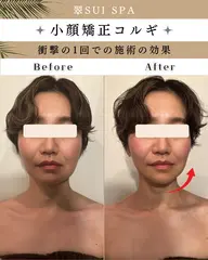 【リピート率NO.1🥇速攻リフトUP✨】 小顔矯正コルギ/首肩・リンパマッサージ付き💆‍♀️