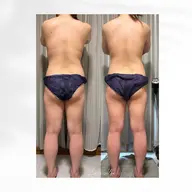 デトックス全身90分引き締め!痩身マシン✖️強力マッサージ【ビフォーアフター写真掲載可能な方・後ろ姿】