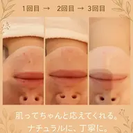 新メニュー♡organicニキビケアフェイシャル♡お茶菓子スイーツ付き🩷