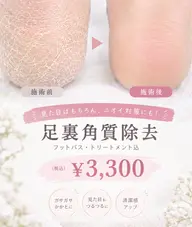 🫧フット足裏角質ケア🫧