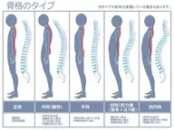 骨盤矯正+猫背矯正