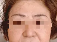 ​〜​Microblading​〜​リペア