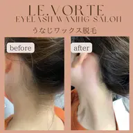 成人式にピッタリ!🩵うなじワックス脱毛🩵保湿パック付き🩵