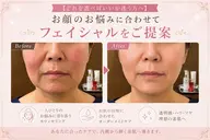 【どれを選べばいいか迷う方へ】お顔のお悩みに合わせてフェイシャルをご提案