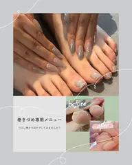【巻き爪ケア3回/経過写真撮影モデル】左右親指1本ずつクリア仕上げ