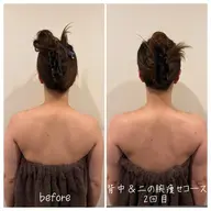 二の腕&背中痩せ45分【5回コース】