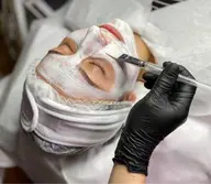 人気NO.7🥣🫧【ツヤ美肌】 美容針を超えたリフティング美白.滑らか"ツヤ肌"マイクロニードル🪡ピーリング単品🪡