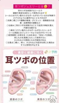 耳ツボチタンシール6粒