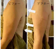 【二の腕痩せ】【パーツ痩せ45分】半袖からでる気になる二の腕を綺麗に🔥肩がいつも重だるい方にも✨岩盤ヒートマットで発汗