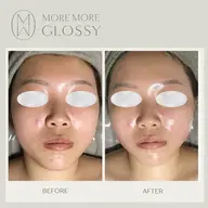エラの張り、食いしばりのお悩みに特化📣💎眠れる美女コルギ70分/お悩み別に特化した施術で理想のフェイスラインに◎💆