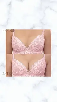 💎最強🔥切らない豊胸🔥美バストアップフルコース120分💎本気で変わりたい方🥹バスト悩みを撃退💪根本ケア✨