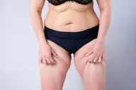【中半身脂肪撃退】痩せにくい下半身に！短期集中痩せでこびりついたセ.ル脂肪解消★超得美脚コース¥7800→¥6800