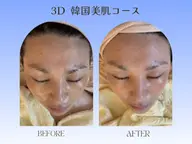 【白玉肌】×【水光肌】3D韓国美肌コース