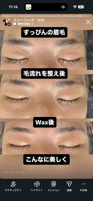 10月31日まで❣️✨究極の垢抜け✨【全身脱毛(顔・VIO込)×HBL】次世代眉毛+全身うるツヤ素肌へ♡