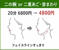 痩身エステ【二重顎or二の腕】20分