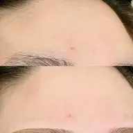 Wax(間引き込み)+額wax+保湿パック付き