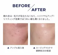 【本気の肌管理】肌悩み別で選べる3つのアンプル