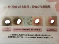 ローマピンクカウンセリング